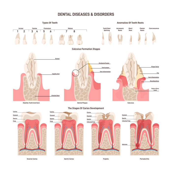 Dental disorders set