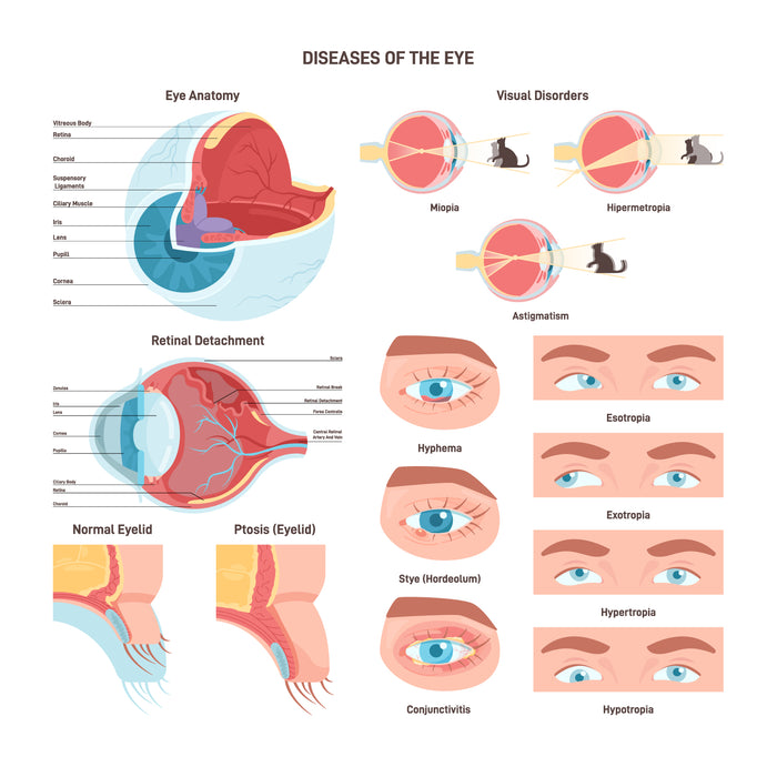 Diseases of the eye set