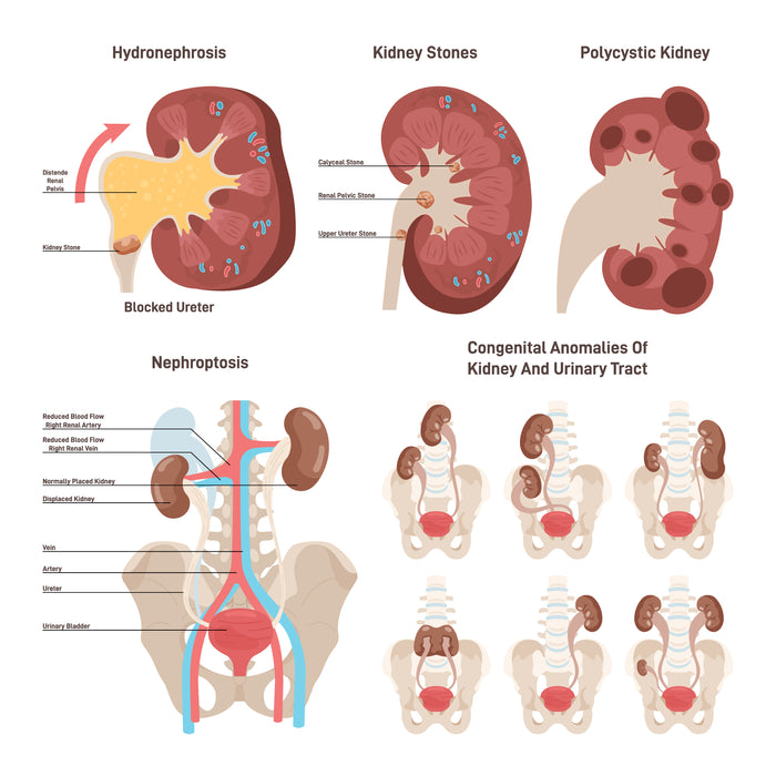 Kidney diseases set