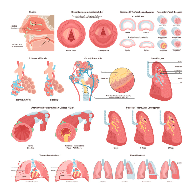 Respiratory tract diseases set